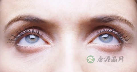 男人怎么消除眼袋