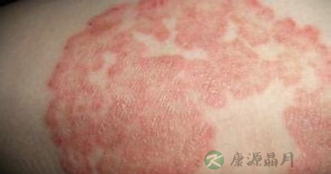 女人湿毒症状