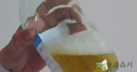 小儿尿蛋白高的原因