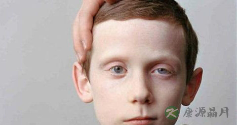 儿童出现嘴歪是什么病