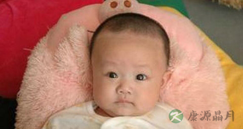 小孩出虚汗怎么办