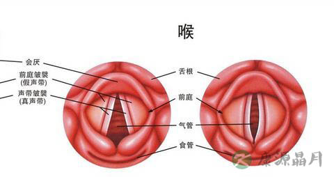 慢性咽炎怎么治疗
