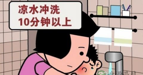 户外烫伤如何自救