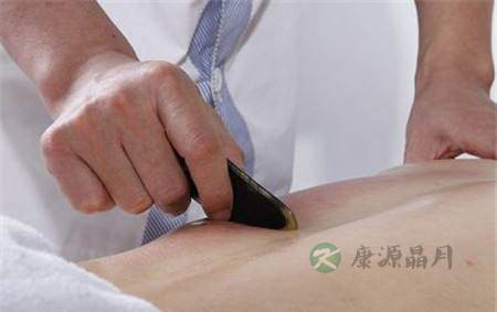 经常刮痧可以减肥吗