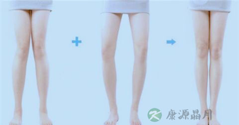 矫正腿型的方法
