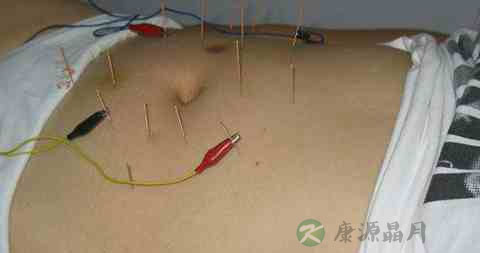 针灸按摩能减肥吗
