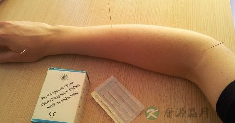 用艾灸多久可以减肥吗