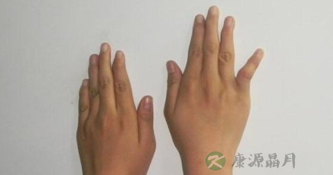 肌肉会萎缩吗