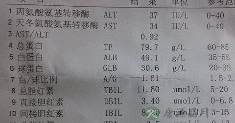 肝功能检查项目有哪些