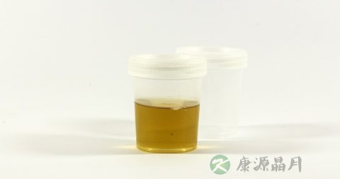 尿检蛋白质正常值