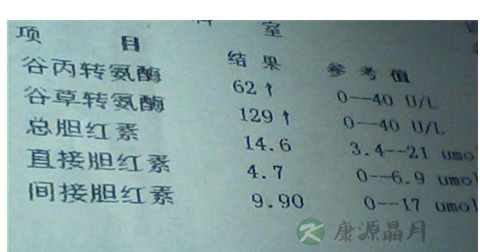 谷丙转氨酶正常值