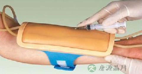 穿刺疼吗