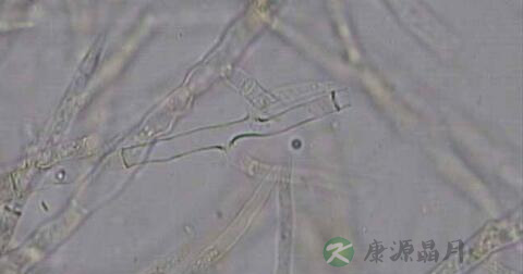 念珠菌阳性怎么回事