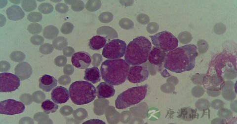 嗜酸性粒细胞计数正常值是多少