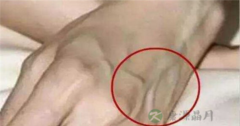 血管明显的原因