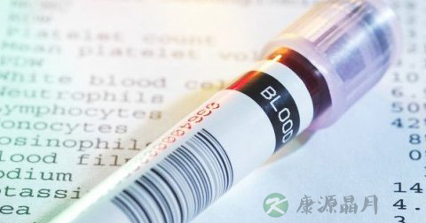 血脂检查项目有哪些