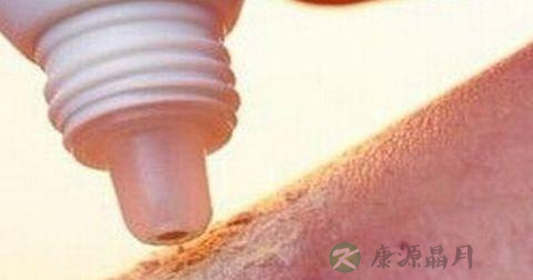 缝针后几天拆线