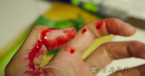 血友病是什么