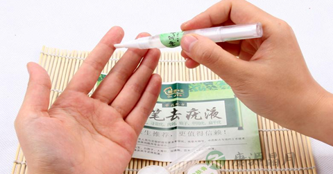 瘊子有什么危害