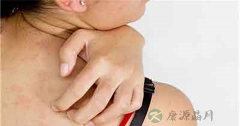 丘疹怎么引起的