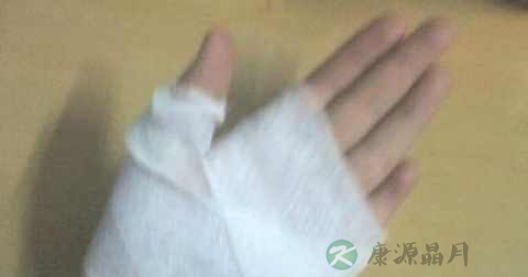烫伤为什么要用弹力绷带