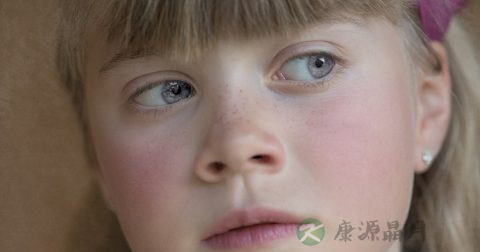 火疖子是什么