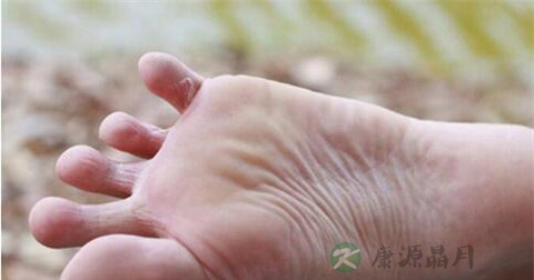 脚丹毒是怎么引起的