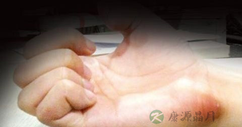 什么是腱鞘炎