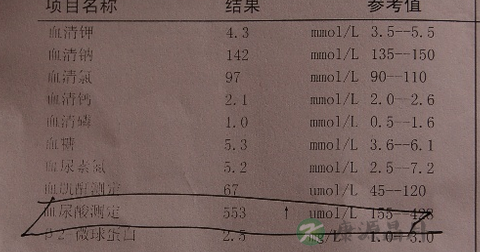 尿酸的正常值