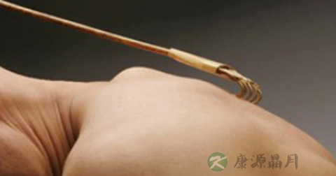 毛囊炎引起淋巴结肿大吗