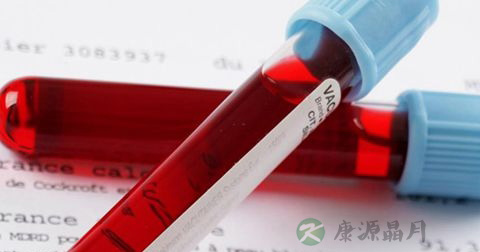 结合胆红素偏高的原因
