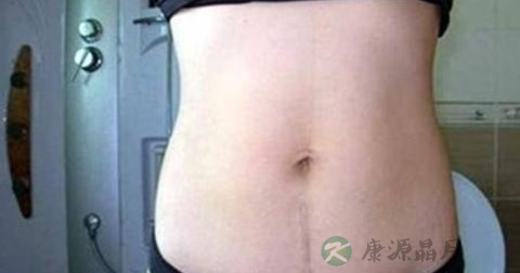 缝针后几天拆线