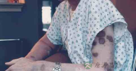 艾滋病有什么病毒引起