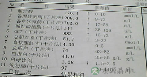 胆汁酸怎么办