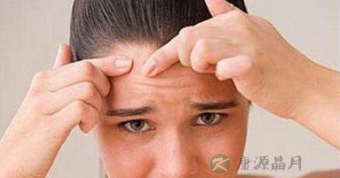 痤疮丙酸杆菌怎么治疗