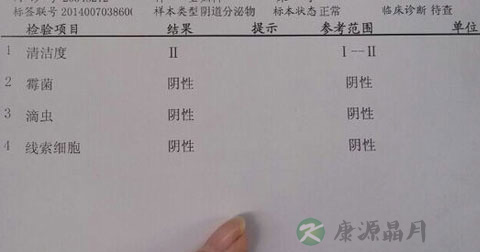 白带常规检查