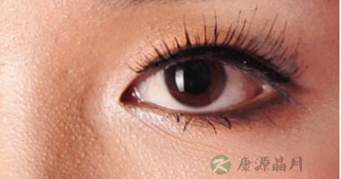 什么是红眼病