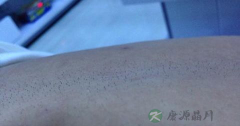 肛门毛囊炎挂什么科