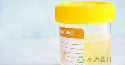 蛋白尿是怎么回事