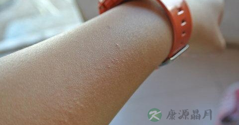什么能导致皮炎