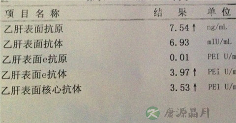 乙肝化验单怎么看