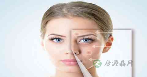 红肿擦什么药好