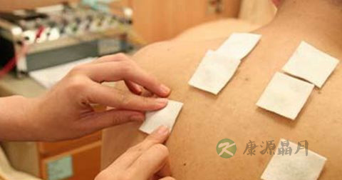 三伏贴的副作用