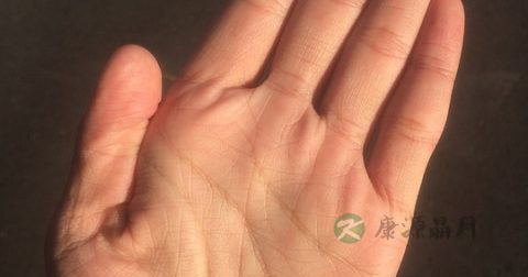 鹅掌风特效药