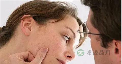 治疗痤疮疤痕的方法