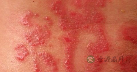 炉甘石洗剂价格