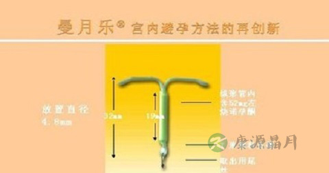 曼月乐的副作用