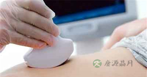 女人紧急避孕吃什么药最好