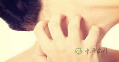皮肤过敏药有哪些
