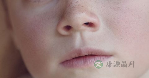治疗痤疮的药
